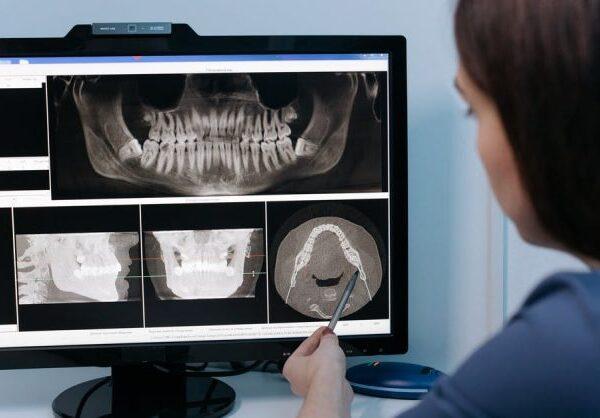 OPG Dental X-ray machine - OPG Dental X-ray Centre in Dehradun
