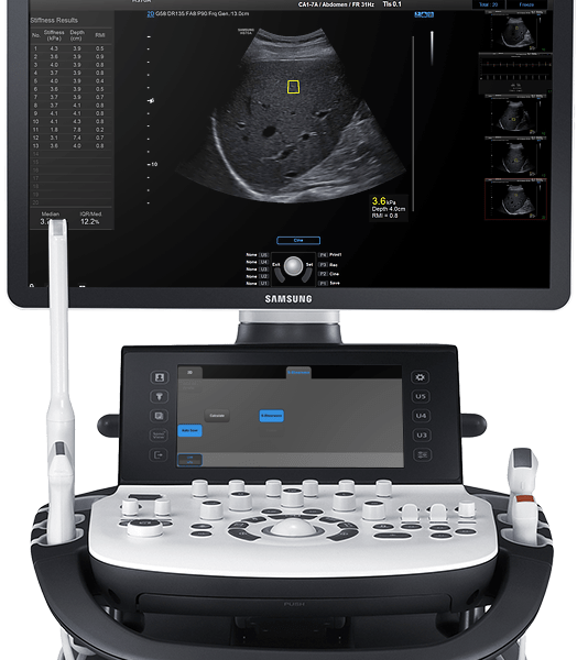 Elastography Test Machine - Elastography Centre in Dehradun