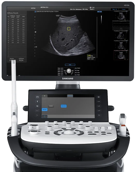 Elastography Test Machine - Elastography Centre in Dehradun