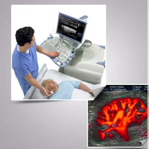 How ECG is done for ladies