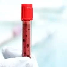 full blood count