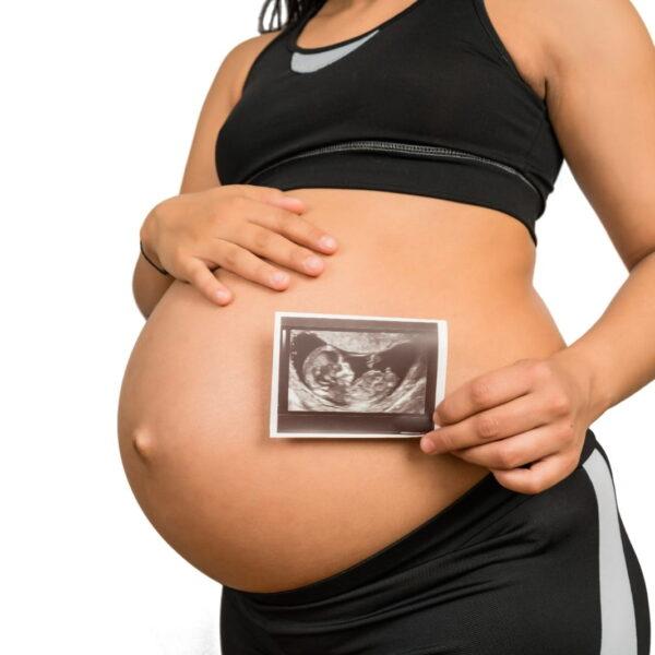 Ultrasound Scan Pregnancy