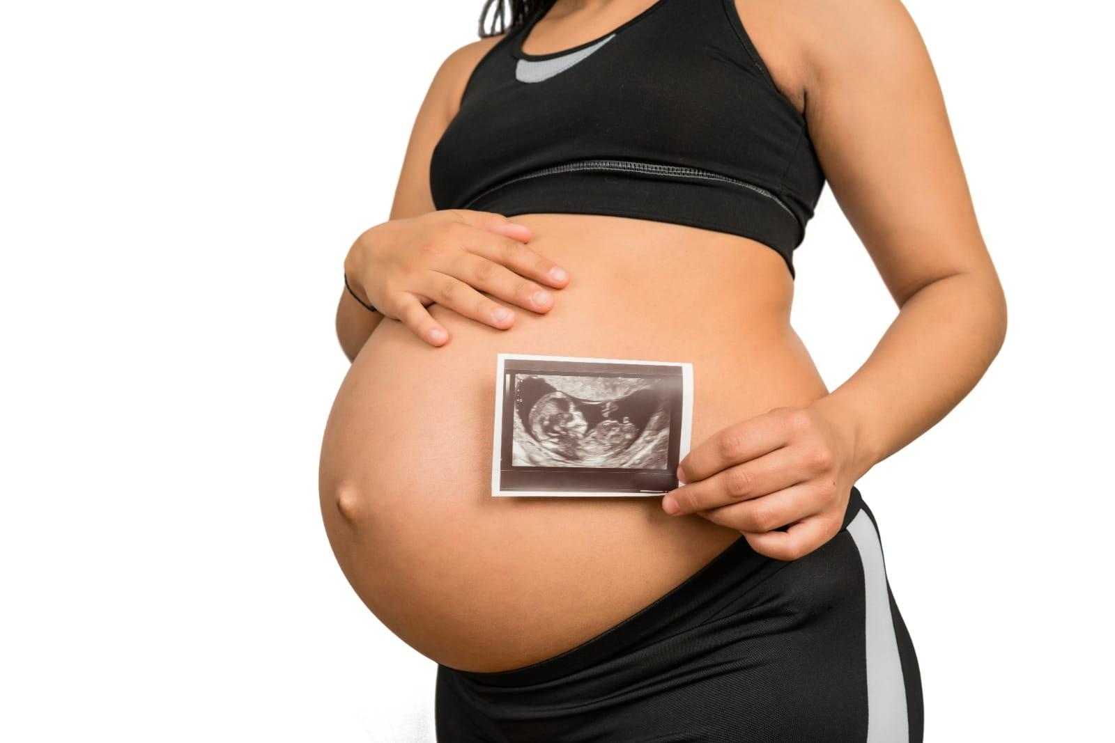 Ultrasound Scan Pregnancy