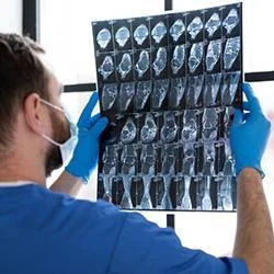 CT Brain Scan Test in Dehradun