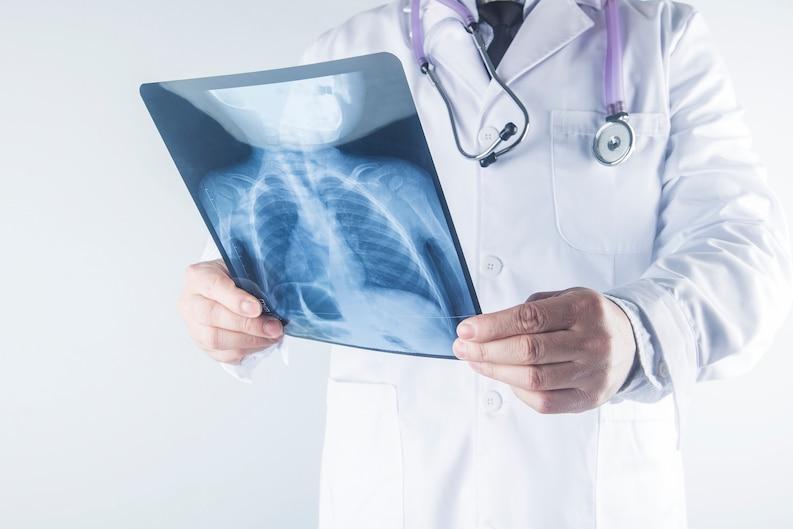 X-ray