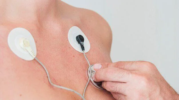 Ecg for heart attack