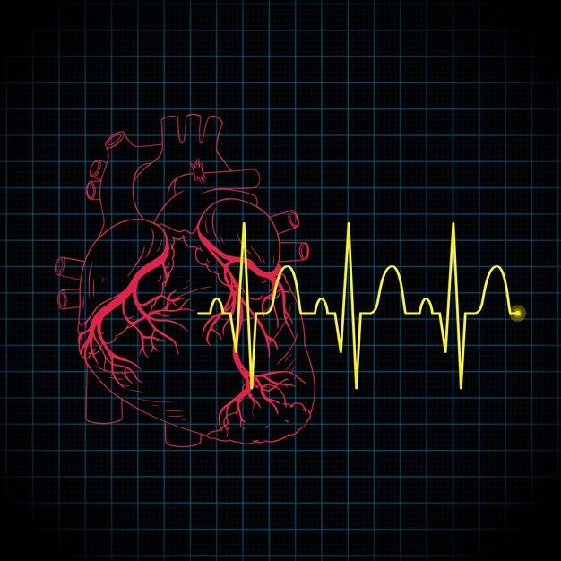 does ecg detects heart attack