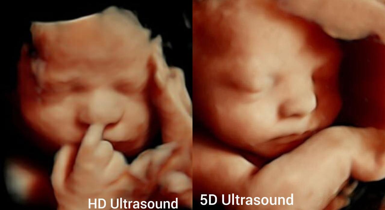 5D ultrasounds