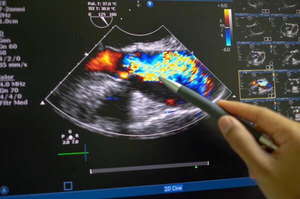 Colour Doppler Ultrasound in Pregnancy