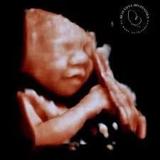 ultrasound