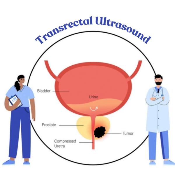 Transrectal Ultrasound