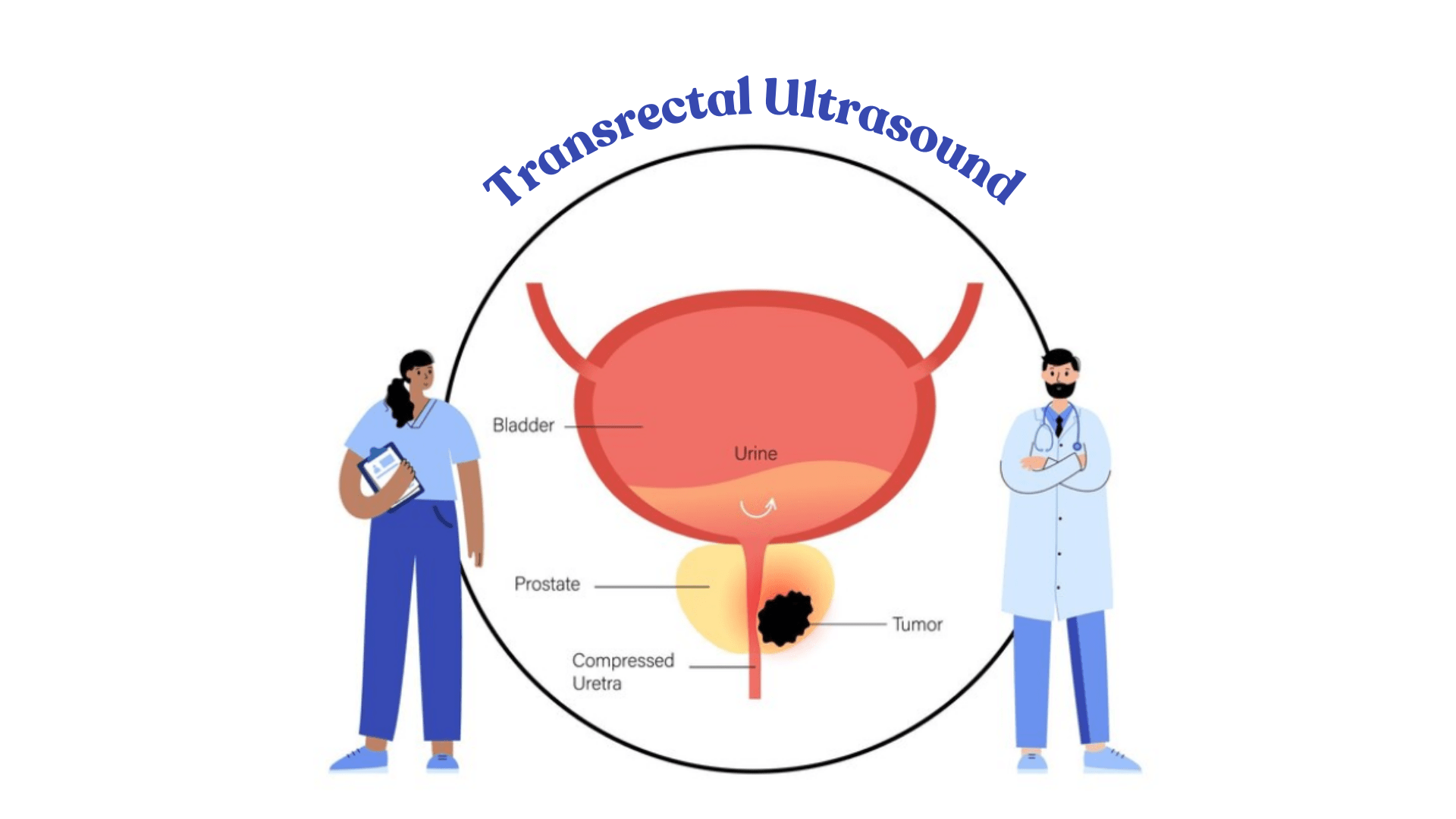 Transrectal Ultrasound