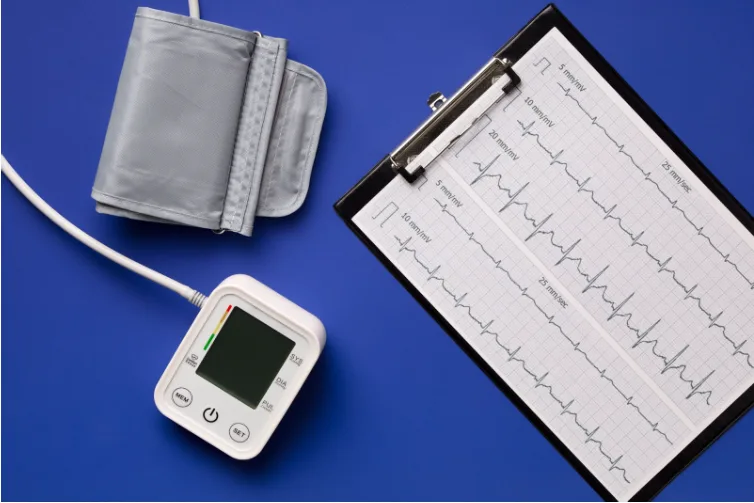 atrial fibrillation ecg
